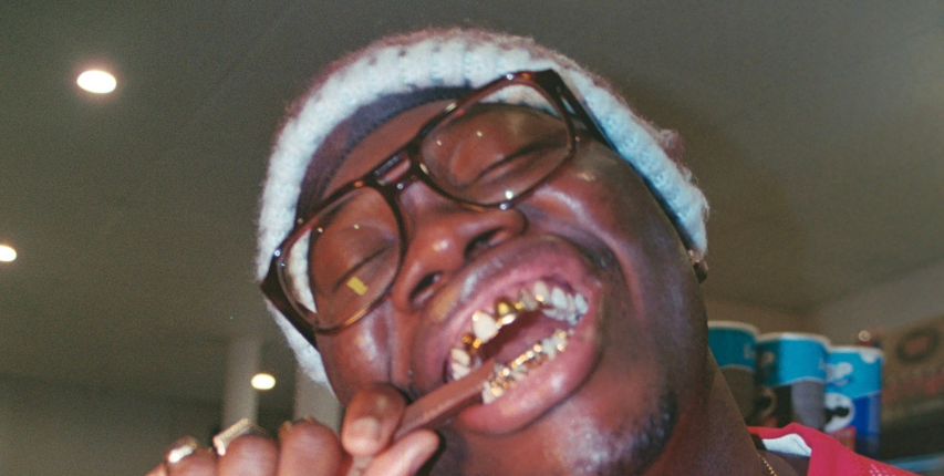 Grillz sur mesure Rennes, Bretagne