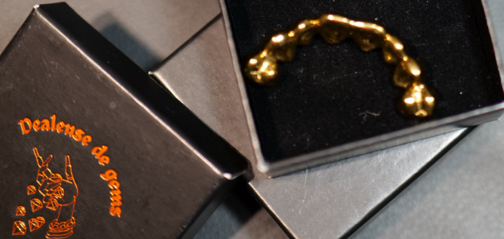 Grillz sur mesure à Rennes - bretagne