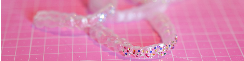 Grillz sur mesure Rennes